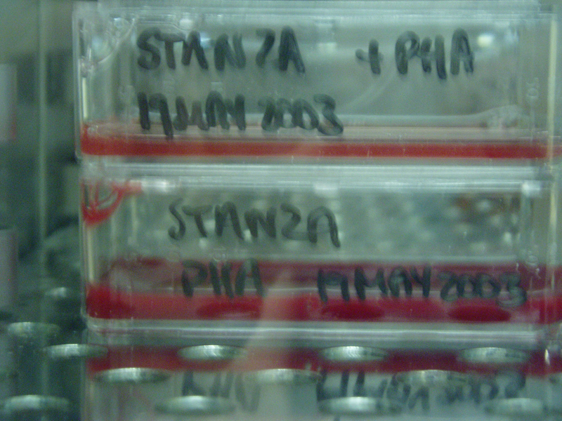 Stanza DNA sequencing 2003 used for art experiment.